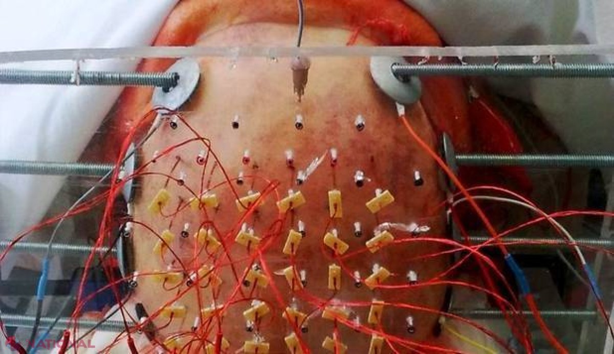 FOTO // Studiul unor cercetătări UNGURI pe un CADAVRU demonstrează în ce PERICOL suntem cu toţii 