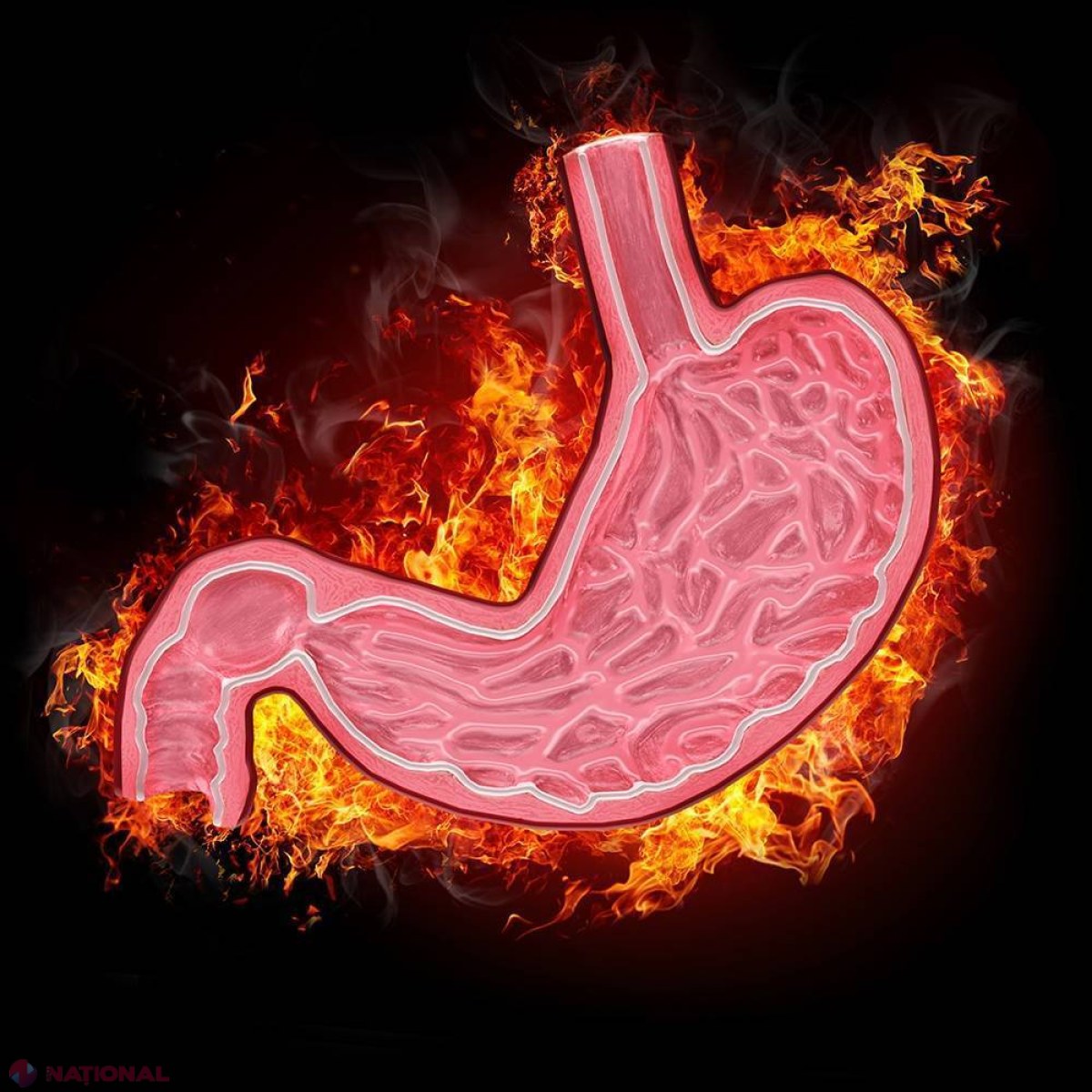 UTIL // Suferi de aciditate gastrică? Un remediu BANAL te poate ajuta imediat