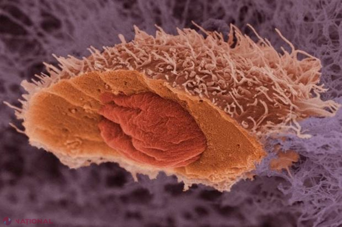 Leacum pentru orice tip de cancer a fost descoperit. Cum se dizolvă orice tumoare în câteva săptămâni