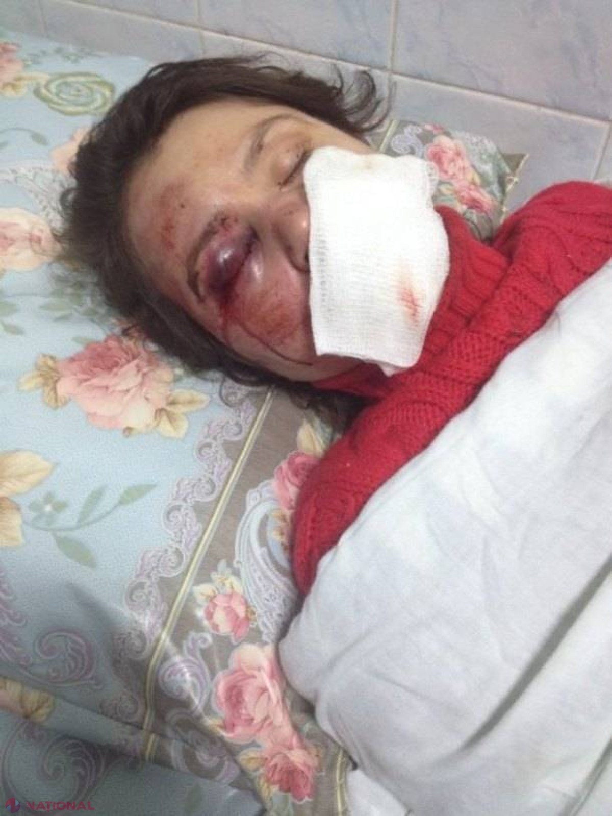 FOTO VIDEO // ȘOCANT! Jurnalistă din UCRAINA, bătută VIOLENT și DESFIGURATĂ la KIEV