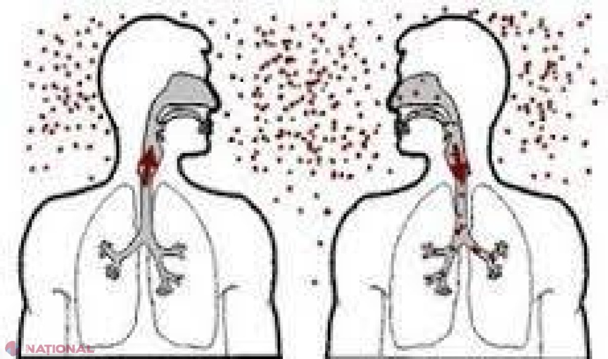 Tuberculoza, o importantă problemă de sănătate publică