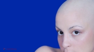 cancerul feminin)