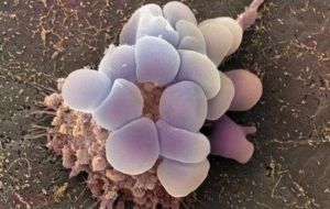 SFATURILE experţilor pentru a preveni apariţia cancerului