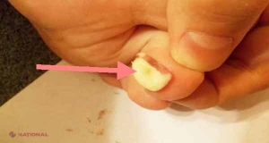 Pune un cățel de usturoi între două degete de la picioare. Iată ce se întâmplă!