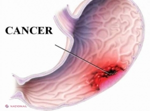 Știi ce mănânci? NU prea! INSECTICID ANTI-PĂDUCHI în desertul preferat al COPILULUI TAU! 