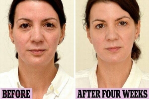 A băut trei litri de apă pe zi timp de o lună. A rămas UIMITĂ de schimbare