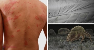 ACARIENII din aşternuturi provoacă îmbolnăviri – scapă de ei cu această soluţie simplă!