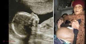 O femeie a fost însărcinată timp de 60 de ani. Cum arăta PRUNCUL când, în sfârşit, l-au adus pe lume?