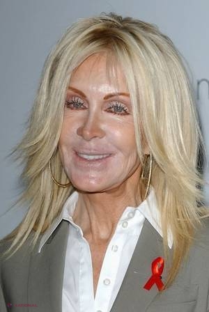 GALERIE FOTO // Cum arăta Joan Van Ark înainte de operaţiile estetice