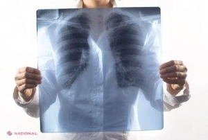 INOVAȚIE // Dispozitivul care permite unor plămâni „să respire” în AFARA corpului