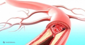 DIETĂ // Băutura plină „de sănătate”! Te ajută să elimini toxinele și să slăbești