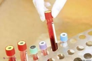 Bolile care OMOARĂ cei mai mulți moldoveni