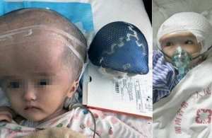 Premieră mondială. Transplant INCREDIBIL realizat de medici prin tehnica 3D