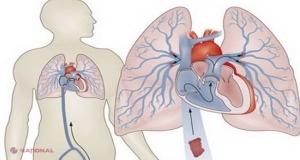 BOLI care vă pot ucide în câteva ore... Descoperă din timp simptomele şi acţionează!