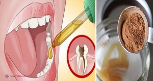 Scapă de DURERILE DE DINŢI combinând două ingrediente simple!