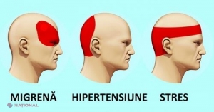 Cum să scapi de DUREREA DE CAP în 5 minute FĂRĂ PASTILE