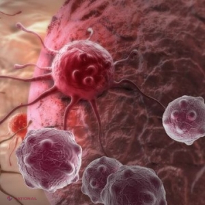 Nouă simptome ale CANCERULUI pe care nu trebuie să le ignori