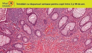 Care este cel mai lung organ din corpul omenesc?