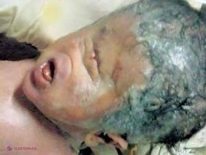 FOTO // Bebelușul-ciclop, născut în India