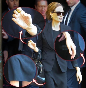 FOTO // Angelina Jolie, internată în SPITAL de urgenţă! A ajuns să CÂNTĂREASCĂ 35 kg