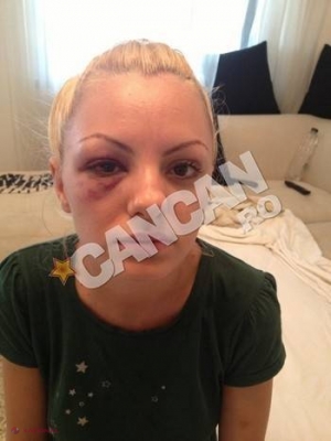 Alexandra Stan, SNOPITĂ ÎN BĂTAIE de manager: „Nu am avut niciun accident” (POZE)