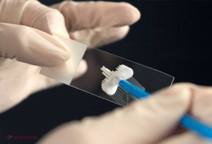 UTIL // Un laborator privat din Chișinău efectuează GRATUIT teste pentru screening-ul la cancerul de col uterin până pe31 ianuarie