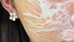 S-a spălat pe față timp de mai multe zile cu pasta de dinți. E incredibil ce i s-a întâmplat 