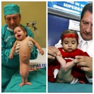 „Fetiţă sirenă” uimea o lume întreagă cu povestea ei! Anii au trecut, iar micuţa a crescut! Cum arată acum 