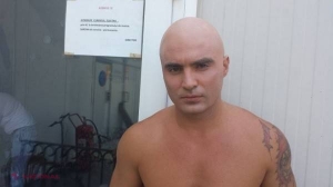 Pepe, imagine şocantă! Uite de ce a rămas complet chel!