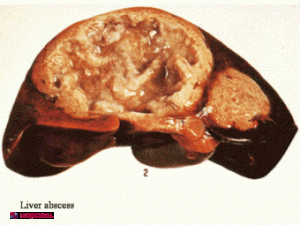 LEACUL MIRACULOS pentru refacerea ficatului. E sută la sută natural! 