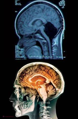 Doar NOUĂ oameni din lume pot trăi aşa. Tomografia care i-a UIMIT pe medici