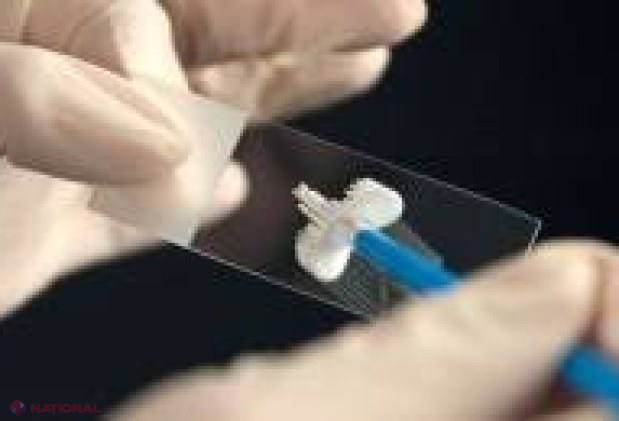 NOU în R. Moldova! Screening pentru prevenirea cancerului de col uterin