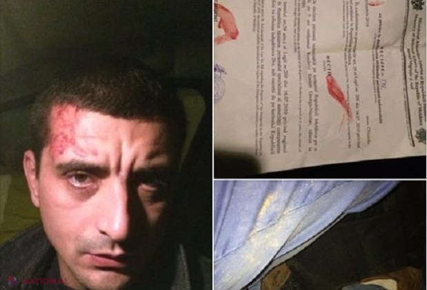 Poliția de Frontieră susține că George Simion NU era bătut atunci când a fost predat autorităților române