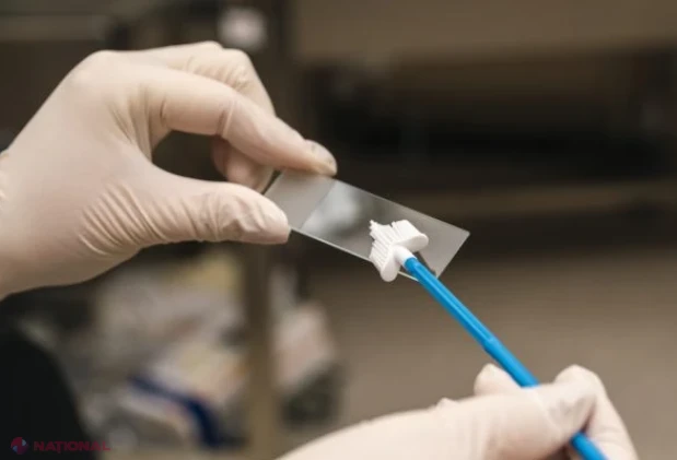 Cum transformă medicii de familie screeningul de col uterin într-un serviciu gratuit și accesibil pentru toate femeile din Republica Moldova