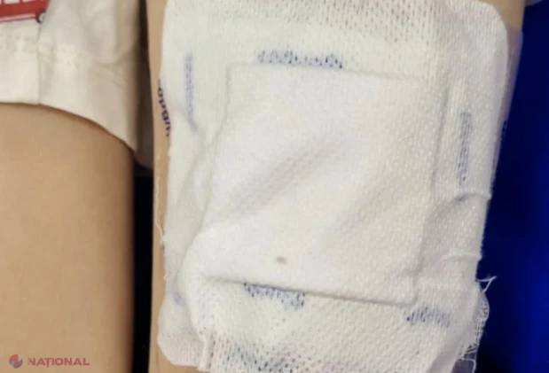 Copil de 6 ani din Botoșani, în comă după plasturi cu fentanil puși pe o rană. Avertismentul medicului Radu Țincu: risc major de stop respirator la supradoză