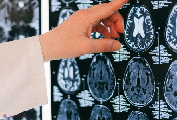 Prof. dr. Dafin Mureșanu: Trei obiceiuri simple care ne ajută să ne menținem creierul sănătosેણ