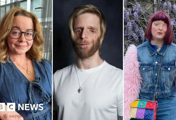 Inteligența artificială șterge diferențele vizibile pentru a face oamenii să pară „normali”