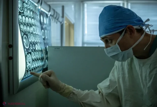 Cum poate RMN-ul de difuzie să ajute pacienții cu AVC când nu se cunoaște ora debutului