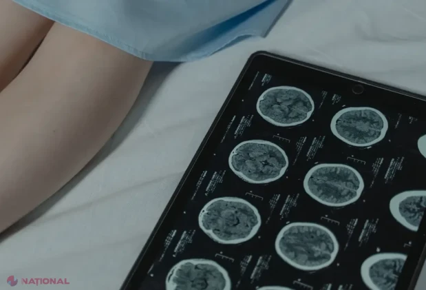 „Nu vreau să fim singuri”: provocările pacienților cu epilepsii rare în România