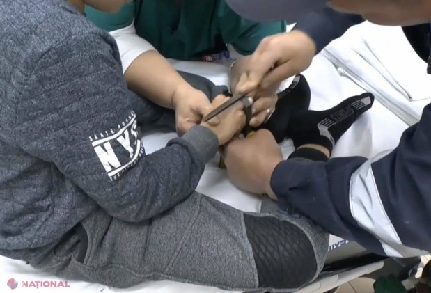 VIDEO // Copii de la Bălți, cu inele BLOCATE pe degete