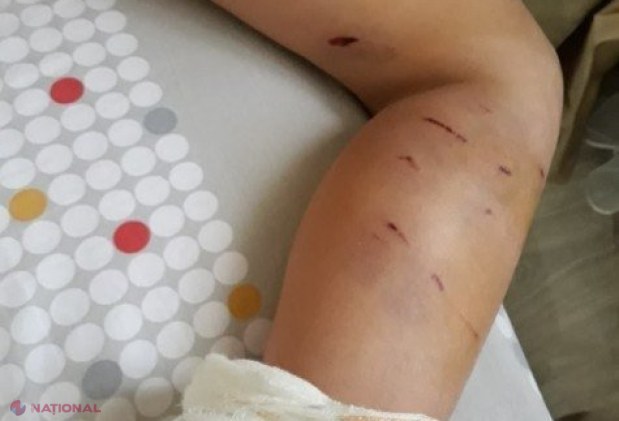 Copil de 7 ani din R. Moldova, atacat de ȘAPTE maidanezi chiar în curtea școlii în care învață: „L-au doborât la pământ, l-au mușcat de picioare și nimeni nu i-a sărit în ajutor”