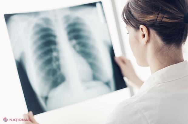 Inteligența Artificială ar putea depista bolile pulmonare după un simplu strănut