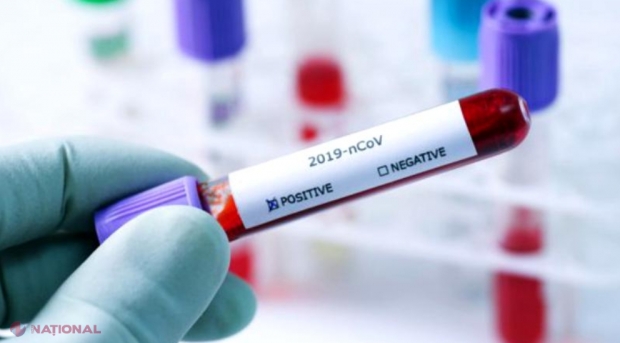 Cât costă, de fapt, dezvoltarea unui vaccin împotriva unui virus cum este COVID-19