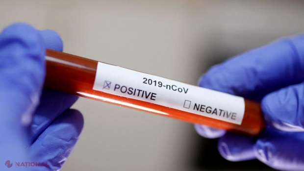 CORONAVIRUS // Plus 872 de cazuri în ultima zi și încă nouă morți: Aproape jumătate - în Chișinău