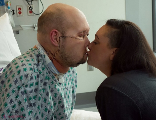 Premieră medicală. Primul transplant total de ochi, efectuat de medici din SUA