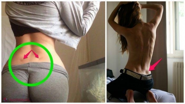 Ce înseamnă dacă ai aceste gropițe la baza coloanei?