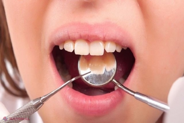 Modalităţi eficiente de a elimina placa dentară ACASĂ