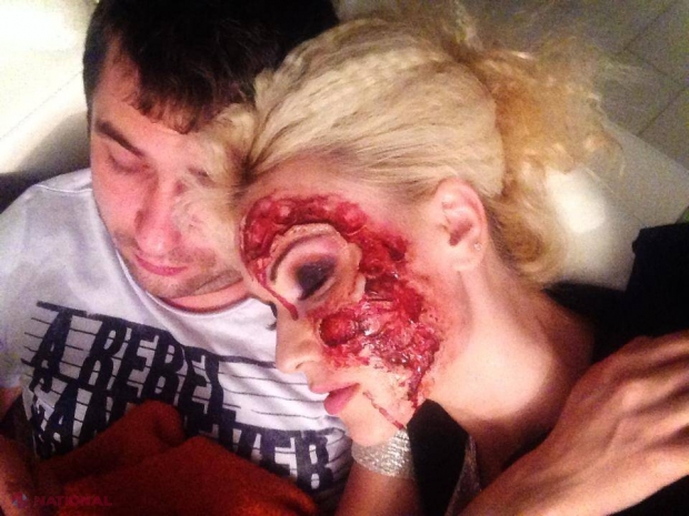 FOTO // O interpretă din R. Moldova a fost „BĂTUTĂ CRUNT” noaptea trecută