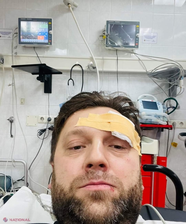FOTO // Noul ministru al Economiei, victima unui ,,ACCIDENT tâmpit