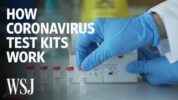 Test RAPID de coronavirus. Dacă tubul își schimbă culoarea în 30 de minute, ești pozitiv la COVID-19